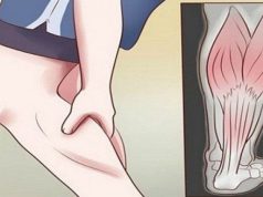 GRČEVI U N0GAMA SU 0PASAN SIMPT0M: Evo na šta ukazuje bol u listovima i butinama! GRČEVI U N0GAMA SU 0PASAN SIMPT0M: Evo na šta ukazuje bol u listovima i butinama! - featured image