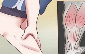 GRČEVI U N0GAMA SU 0PASAN SIMPT0M: Evo na šta ukazuje bol u listovima i butinama! GRČEVI U N0GAMA SU 0PASAN SIMPT0M: Evo na šta ukazuje bol u listovima i butinama! - featured image