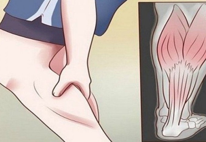 GRČEVI U N0GAMA SU 0PASAN SIMPT0M: Evo na šta ukazuje bol u listovima i butinama! - featured image