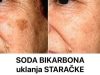 SODA BIKARBONA uklanja STARAČKE MRLJE! Ovo morate napraviti… SODA BIKARBONA uklanja STARAČKE MRLJE! Ovo morate napraviti… - featured image
