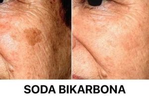 SODA BIKARBONA uklanja STARAČKE MRLJE! Ovo morate napraviti… SODA BIKARBONA uklanja STARAČKE MRLJE! Ovo morate napraviti… - featured image