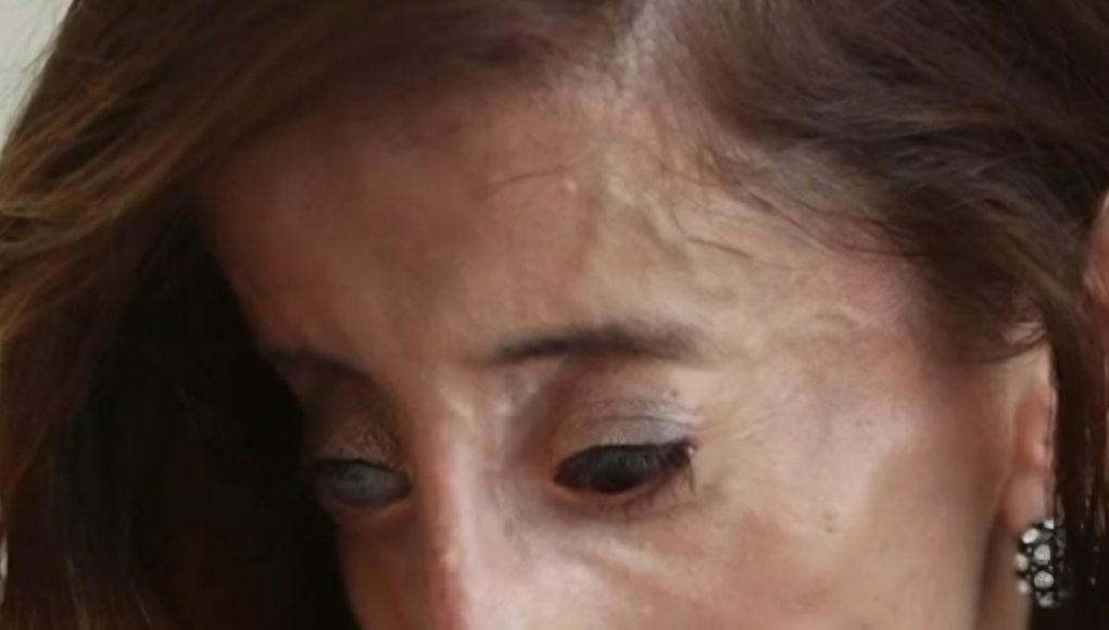 Rekli su joj da je najružnija žena na svijetu i da se ubije – ovo je njen odgovor - featured image