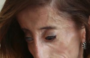 Rekli su joj da je najružnija žena na svijetu i da se ubije – ovo je njen odgovor Rekli su joj da je najružnija žena na svijetu i da se ubije – ovo je njen odgovor - featured image