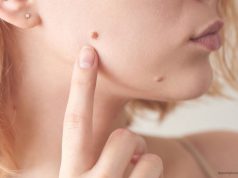 Iz mladeža vam rastu dlačice? Evo što to znači i kada biti na oprezu