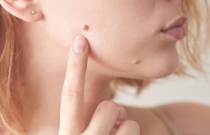 Iz mladeža vam rastu dlačice? Evo što to znači i kada biti na oprezu