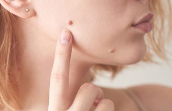 Iz mladeža vam rastu dlačice? Evo što to znači i kada biti na oprezu