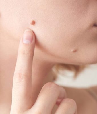 Iz mladeža vam rastu dlačice? Evo što to znači i kada biti na oprezu