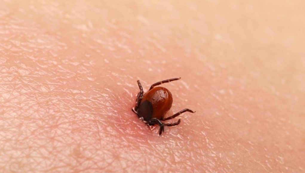 Bezbolno je i nema čupanja: Doktorka otkrila trik kako da se krpelj sam otkači sa kože (video) - featured image