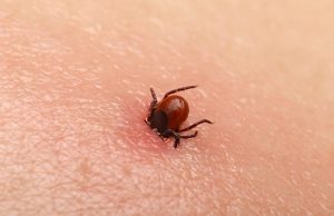 Bezbolno je i nema čupanja: Doktorka otkrila trik kako da se krpelj sam otkači sa kože (video) Bezbolno je i nema čupanja: Doktorka otkrila trik kako da se krpelj sam otkači sa kože (video) - featured image