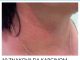 10 ZNAKOVA DA KARCINOM RASTE U VAŠEM TIJELU: Ovo su rani znakovi raka, broj 3 mnogi zanemaruju 10 ZNAKOVA DA KARCINOM RASTE U VAŠEM TIJELU: Ovo su rani znakovi raka, broj 3 mnogi zanemaruju - featured image