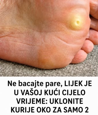 Ne bacajte pare, LIJEK JE U VAŠOJ KUĆI CIJELO VRIJEME: UKLONITE KURIJE OKO ZA SAMO 2 DANA Ne bacajte pare, LIJEK JE U VAŠOJ KUĆI CIJELO VRIJEME: UKLONITE KURIJE OKO ZA SAMO 2 DANA - featured image
