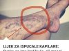 Svatko kod kuće ima lijek za popucale kapilare, ali mnogi ljudi to ne znaju! Svatko kod kuće ima lijek za popucale kapilare, ali mnogi ljudi to ne znaju! - featured image