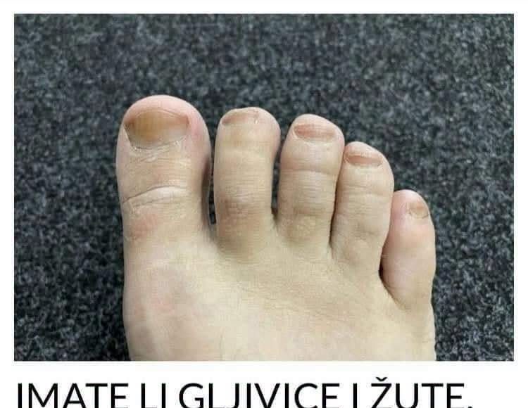 IMATE LI GLJIVICE I ŽUTE, ZADEBLJALE NOKTE: Samo namažite ovo ulje i riješit ćete problem preko noći - featured image IMATE LI GLJIVICE I ŽUTE, ZADEBLJALE NOKTE: Samo namažite ovo ulje i riješit ćete problem preko noći - featured image