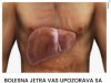 BOLESNA JETRA VAS UPOZORAVA SA OVIH 8 SIMPTOMA: Ako uočite nešto od ovoga, ODMAH DOKTORU DOK NIJE KASNO! BOLESNA JETRA VAS UPOZORAVA SA OVIH 8 SIMPTOMA: Ako uočite nešto od ovoga, ODMAH DOKTORU DOK NIJE KASNO! - featured image