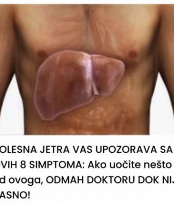 BOLESNA JETRA VAS UPOZORAVA SA OVIH 8 SIMPTOMA: Ako uočite nešto od ovoga, ODMAH DOKTORU DOK NIJE KASNO! BOLESNA JETRA VAS UPOZORAVA SA OVIH 8 SIMPTOMA: Ako uočite nešto od ovoga, ODMAH DOKTORU DOK NIJE KASNO! - featured image
