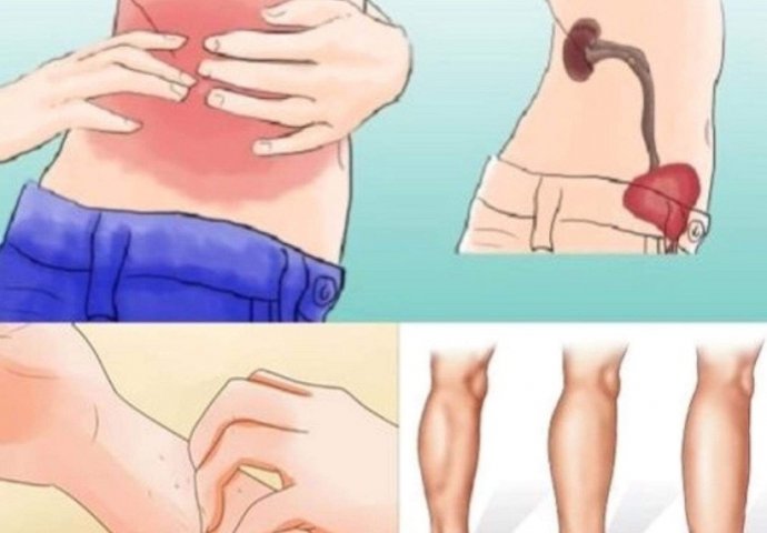 KAD SA BUBREZIMA NIJE SVE U REDU, TIJELO ŠALJE OVE SIGNALE: 6 Simptoma koje ne smijete ignorisati! - featured image