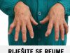 RIJEŠITE SE REUME ZAUVIJEK: Niti jedan lijek joj nije pomogao da izliječi REUMU, a onda je primjenila ovaj recept i ZAUVIJEK riješila svoj problem! RIJEŠITE SE REUME ZAUVIJEK: Niti jedan lijek joj nije pomogao da izliječi REUMU, a onda je primjenila ovaj recept i ZAUVIJEK riješila svoj problem! - featured image
