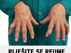 RIJEŠITE SE REUME ZAUVIJEK: Niti jedan lijek joj nije pomogao da izliječi REUMU, a onda je primjenila ovaj recept i ZAUVIJEK riješila svoj problem! RIJEŠITE SE REUME ZAUVIJEK: Niti jedan lijek joj nije pomogao da izliječi REUMU, a onda je primjenila ovaj recept i ZAUVIJEK riješila svoj problem! - featured image