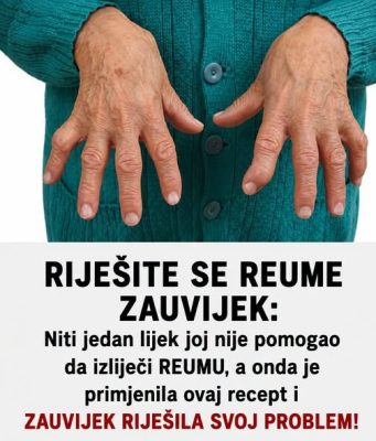 RIJEŠITE SE REUME ZAUVIJEK: Niti jedan lijek joj nije pomogao da izliječi REUMU, a onda je primjenila ovaj recept i ZAUVIJEK riješila svoj problem! RIJEŠITE SE REUME ZAUVIJEK: Niti jedan lijek joj nije pomogao da izliječi REUMU, a onda je primjenila ovaj recept i ZAUVIJEK riješila svoj problem! - featured image