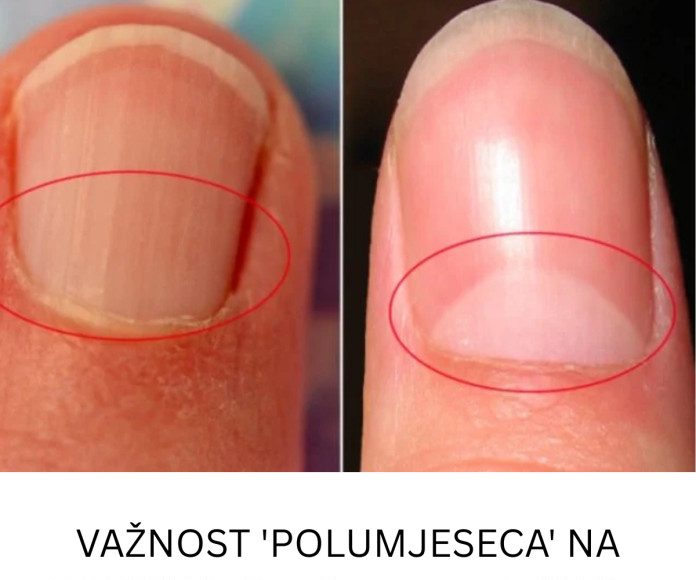 VAŽNOST ‘POLUMJESECA’ NA NOKTIMA: Evo čemu on služi i šta znači ako ga nemate! - featured image