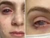 Popila tabletu protiv bolova koju uzimaju mnogi, a onda joj se život zauvijek promijenio Popila tabletu protiv bolova koju uzimaju mnogi, a onda joj se život zauvijek promijenio - featured image