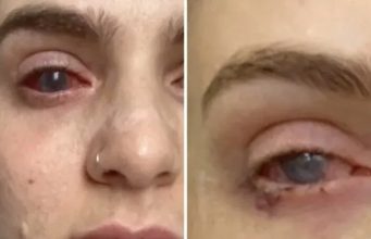 Popila tabletu protiv bolova koju uzimaju mnogi, a onda joj se život zauvijek promijenio Popila tabletu protiv bolova koju uzimaju mnogi, a onda joj se život zauvijek promijenio - featured image