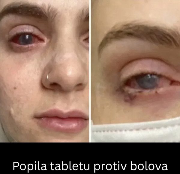 Popila tabletu protiv bolova koju uzimaju mnogi, a onda joj se život zauvijek promijenio - featured image