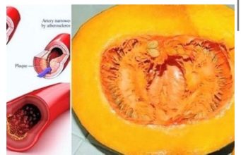 I DOKTORI GA KORISTE: Uz ovaj recept recite ZBOGOM povišenom holesterolu, šećeru u krvi, masnoćama i trigliceridima! I DOKTORI GA KORISTE: Uz ovaj recept recite ZBOGOM povišenom holesterolu, šećeru u krvi, masnoćama i trigliceridima! - featured image