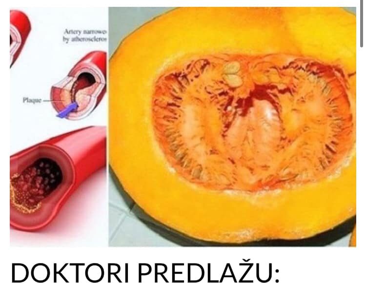 I DOKTORI GA KORISTE: Uz ovaj recept recite ZBOGOM povišenom holesterolu, šećeru u krvi, masnoćama i trigliceridima! - featured image