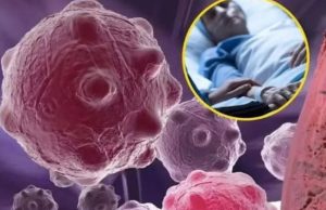 8 namirnica koje smanjuju upale i jačaju imunitet — savršen početak dana 8 namirnica koje smanjuju upale i jačaju imunitet — savršen početak dana - featured image