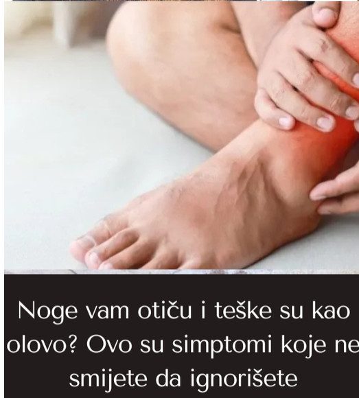 Noge vam otiču i teške su kao olovo? Ovo su simptomi koje ne smijete da ignorišete - featured image