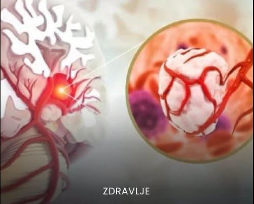 Teške Noge, Umor i Trnci: Savjeti za Svakodnevni Život i Jednostavan Recept za Sok koji Poboljšava Cirkulaciju - featured image