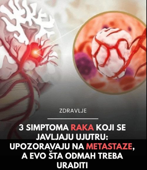 NE IGNORIŠITE IH: Možda su neprijatni, ali ovo su prvi simptomi raka debelog crijeva - featured image