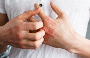 Umor, svrab, VISOK KRVNI PRITISAK, BOL U LEĐIMA – Ova bolest je ”TIHI UBICA”, obratite pažnju ako imate neke od ovih simptoma Umor, svrab, VISOK KRVNI PRITISAK, BOL U LEĐIMA – Ova bolest je ”TIHI UBICA”, obratite pažnju ako imate neke od ovih simptoma - featured image