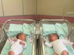 Nakon 20 godina čekanja, napokon su dobili blizance… ali kada je liječnik vidio znak na rukama beba, svi su se zaledili 😱💔👇 Nakon 20 godina čekanja, napokon su dobili blizance… ali kada je liječnik vidio znak na rukama beba, svi su se zaledili 😱💔👇 - featured image