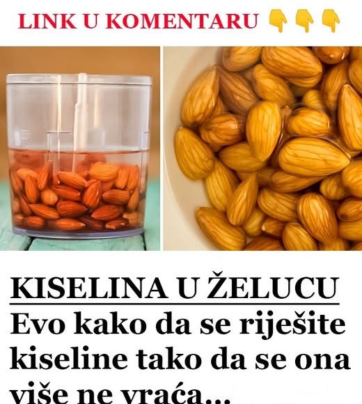 KISELINA U ŽELUCU: Evo KAK0 da se riješite kiseline tako da se 0NA više ne vraća… - featured image