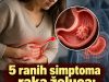 5 ranih simptoma raka želuca: Tumor može da raste godinama, a svi pacijenti prvo osjete ovo 5 ranih simptoma raka želuca: Tumor može da raste godinama, a svi pacijenti prvo osjete ovo - featured image