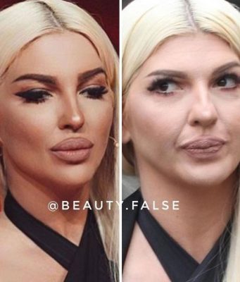 STVARNOST VS INSTAGRAM: Ovako zaista izgledaju pjevačice bez filtera i photoshopa! Ceca je najveće iznenađenje – POGLEDAJTE NJENU NEOBRAĐENU SLIKU (FOTO) STVARNOST VS INSTAGRAM: Ovako zaista izgledaju pjevačice bez filtera i photoshopa! Ceca je najveće iznenađenje – POGLEDAJTE NJENU NEOBRAĐENU SLIKU (FOTO) - featured image