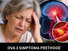 OVA 3 SIMPTOMA PRETHODE MOŽDANOM UDARU! Dr Radak otkrio na šta da OBRATITE PAŽNJU, šlog se javlja u ROKU OD… OVA 3 SIMPTOMA PRETHODE MOŽDANOM UDARU! Dr Radak otkrio na šta da OBRATITE PAŽNJU, šlog se javlja u ROKU OD… - featured image