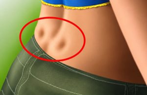 DISKUS HERNIJA: Ovaj DOMAĆI LIJEK potpuno OBNAVLJA KIČMU, JAČA JE I LIJEČI DISKUS HERNIJA: Ovaj DOMAĆI LIJEK potpuno OBNAVLJA KIČMU, JAČA JE I LIJEČI - featured image
