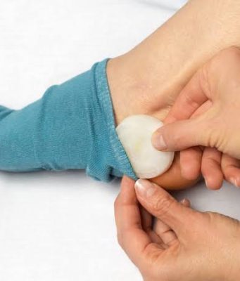 Stavite crni i bijeli luk u čarape i prespavajte u njima: Preporodiće vam tijelo, pogledajte i kako Stavite crni i bijeli luk u čarape i prespavajte u njima: Preporodiće vam tijelo, pogledajte i kako - featured image