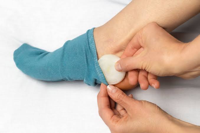 Stavite crni i bijeli luk u čarape i prespavajte u njima: Preporodiće vam tijelo, pogledajte i kako - featured image Stavite crni i bijeli luk u čarape i prespavajte u njima: Preporodiće vam tijelo, pogledajte i kako - featured image