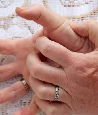 ŠTA ZNAČI KAD VAS SVRBI LIJEVI ILI DESNI DLAN: Sljedeći put ćete makar znati ŠTA VAS ČEKA! ŠTA ZNAČI KAD VAS SVRBI LIJEVI ILI DESNI DLAN: Sljedeći put ćete makar znati ŠTA VAS ČEKA! - featured image