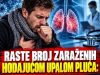 Hodajuća upala pluća: Simptomi koje ne treba zanemariti i kada se javiti lekaru Hodajuća upala pluća: Simptomi koje ne treba zanemariti i kada se javiti lekaru - featured image